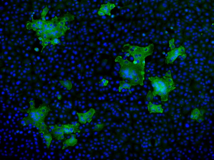 间接免疫荧光显示病毒感染的细胞呈现合胞体